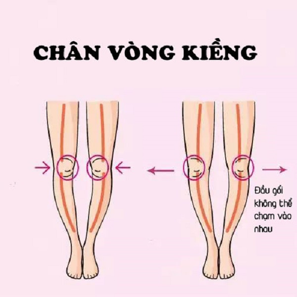 Chua Chan Vong Kieng O Nguoi Lon