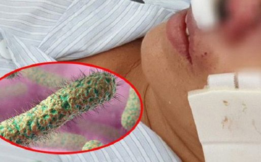 Có virus ăn thịt người ở Việt Nam không