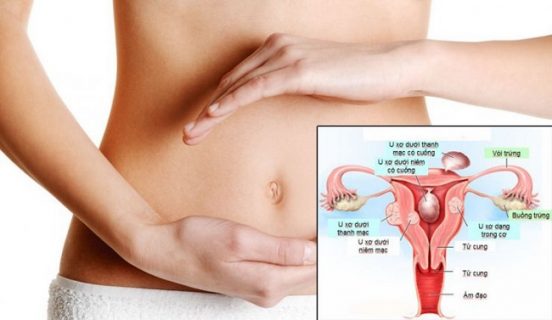 Trễ kinh đau bụng dưới âm ỉ có nguy hiểm không?