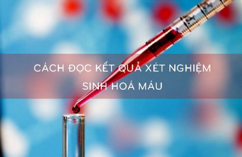 Đọc kết quả xét nghiệm sinh hóa máu như thế nào?