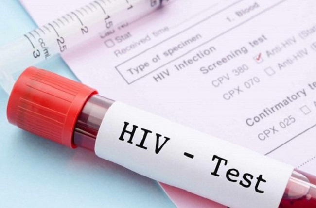 HIV có lây qua đường nước bọt không?