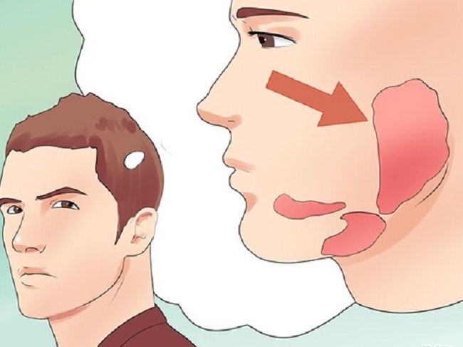 hiện tượng quai bị ở người lớn có sao không?