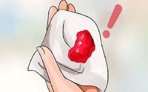 Ra máu sau khi quan hệ nhưng không đau?