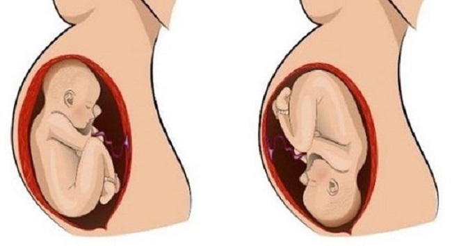 Ngôi Thai Thuận ở Tuần 28 Như Thế Nào1