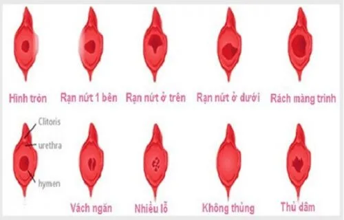 Mang Trinh Co Tu Lanh Duoc Khong 1